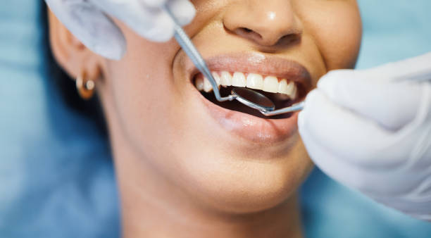Best Emergency Dental Care for Sports Injuries in Grand Mound, WA